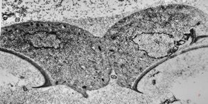 Giardia (Lamblia) intestinalis Giardia (Lamblia) intestinalis